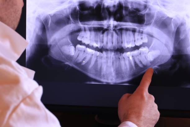 Best Tooth Infection Emergency Dentist  in Wayne, WV